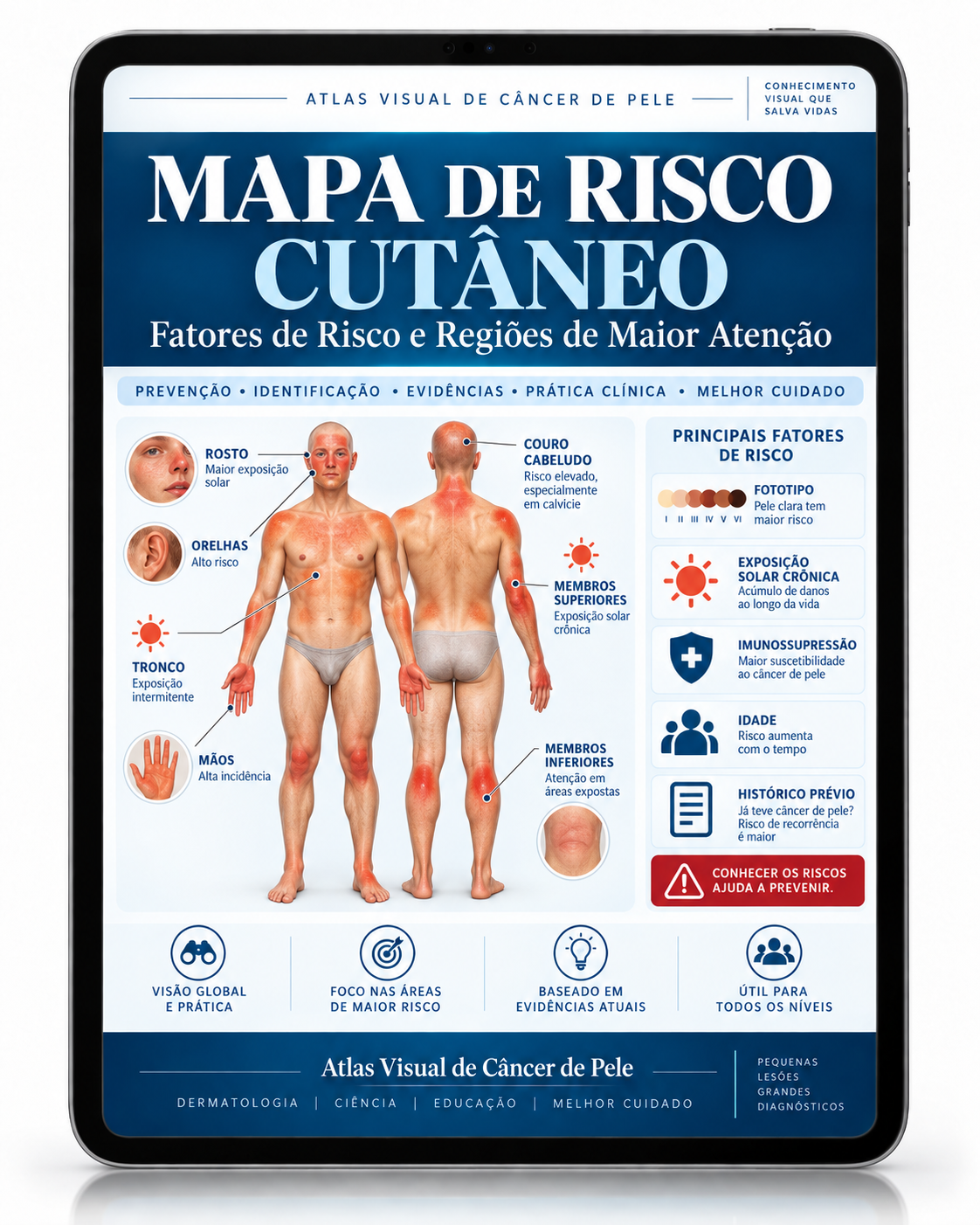 MAPA DE RISCO CUTÂNEO