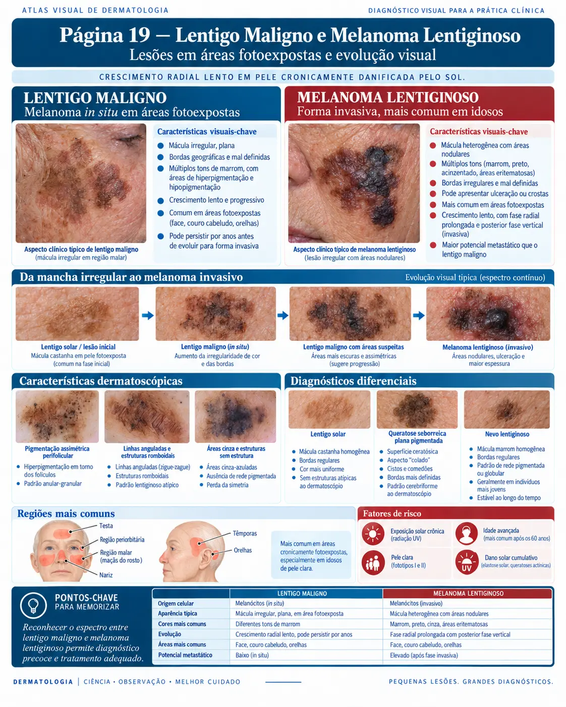 Página do ATLAS VISUAL DE CÂNCER DE PELE: Lentigo Maligno e Melanoma Lentiginoso