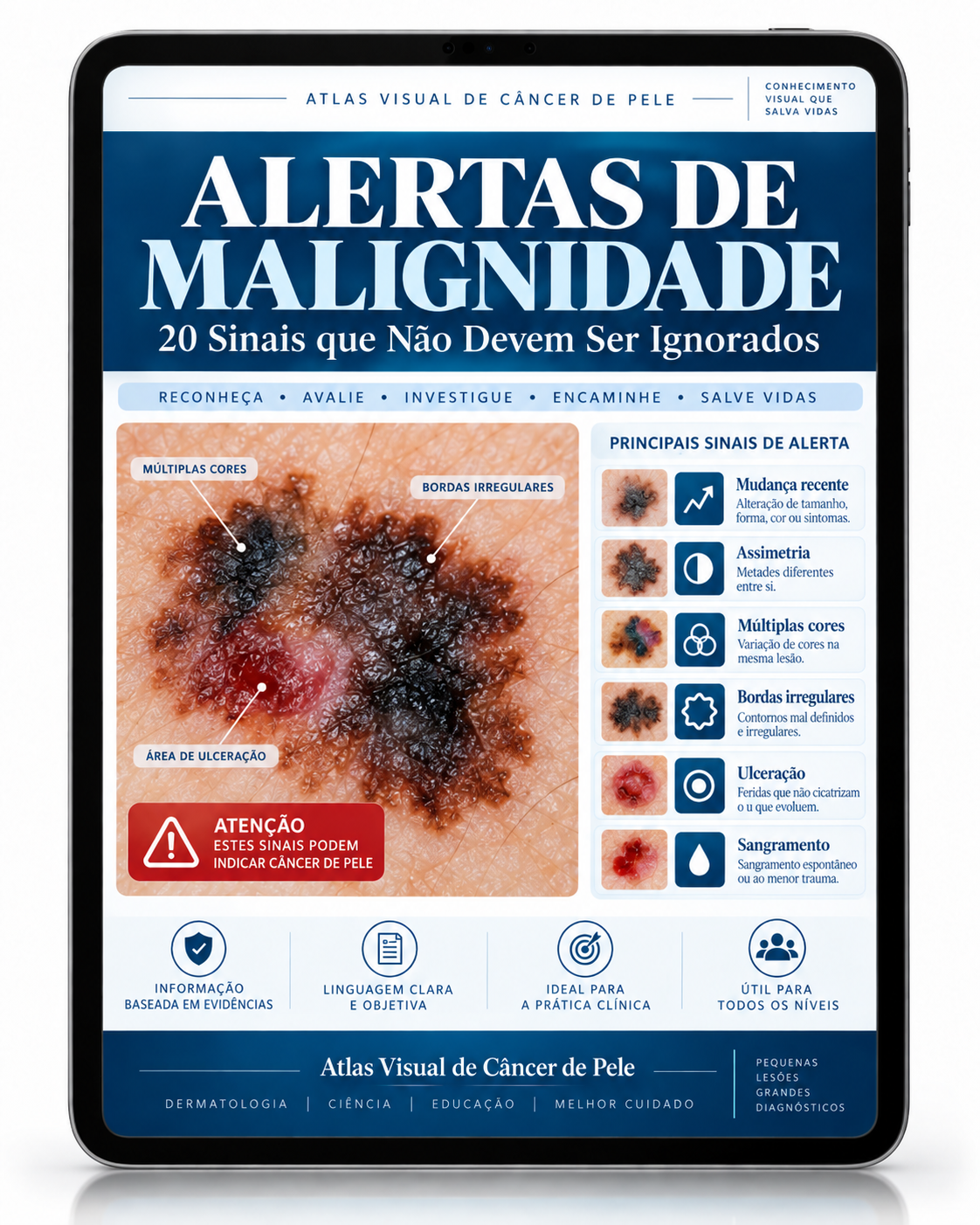 ALERTAS DE MALIGNIDADE