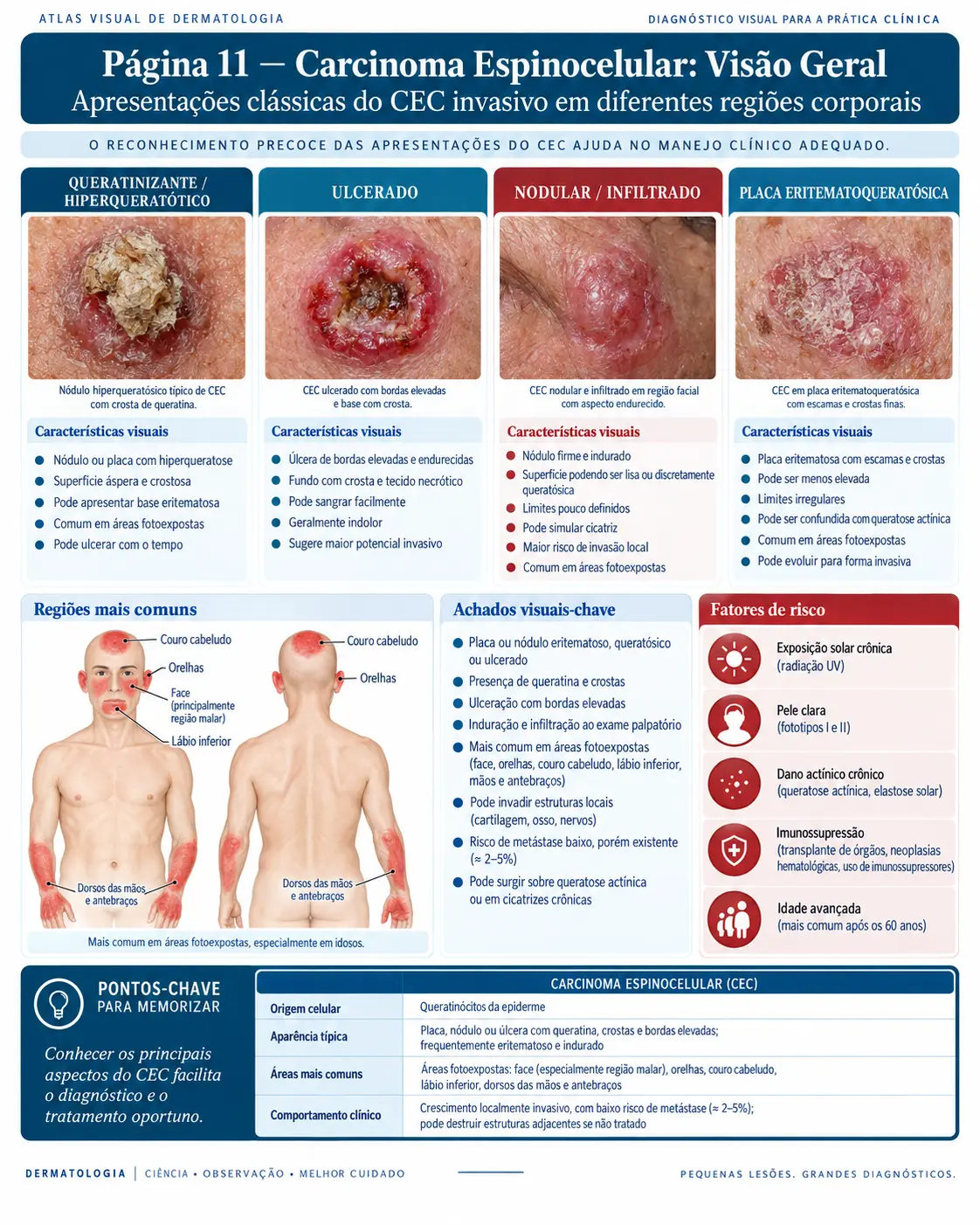 Página do ATLAS VISUAL DE CÂNCER DE PELE: Carcinoma Espinocelular: Visão Geral