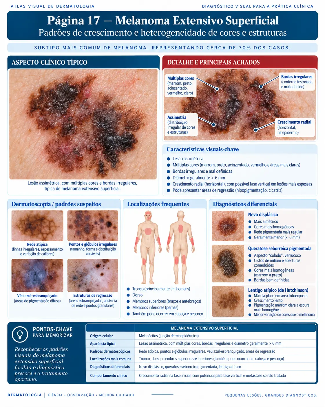 Página do ATLAS VISUAL DE CÂNCER DE PELE: Melanoma Extensivo Superficial