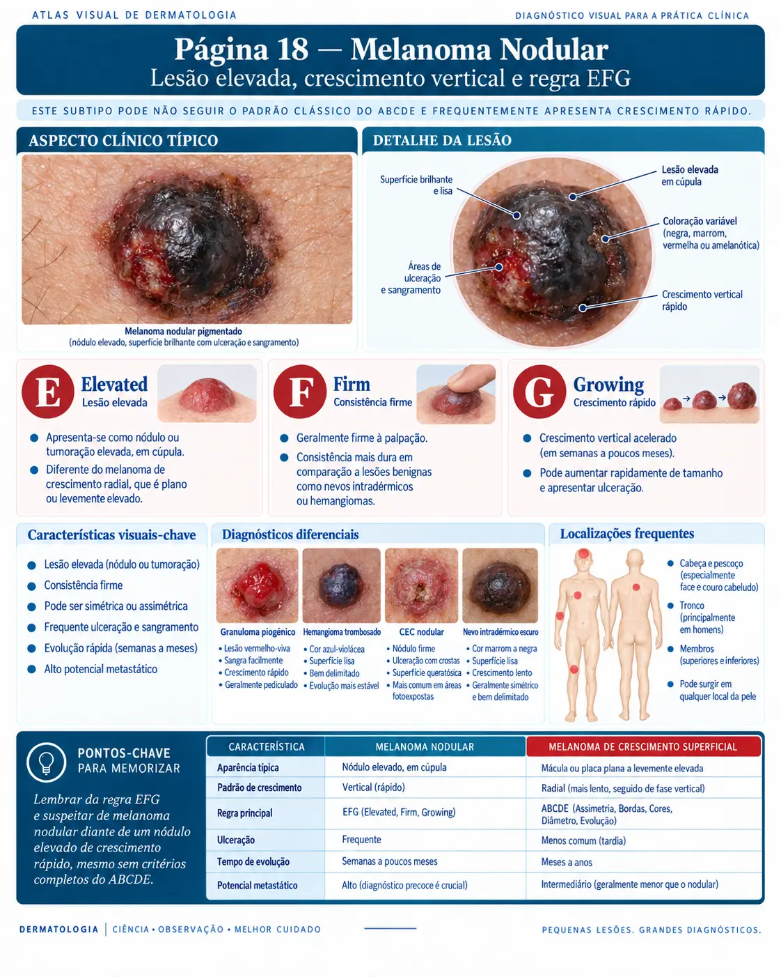 Página do ATLAS VISUAL DE CÂNCER DE PELE: Melanoma Nodular