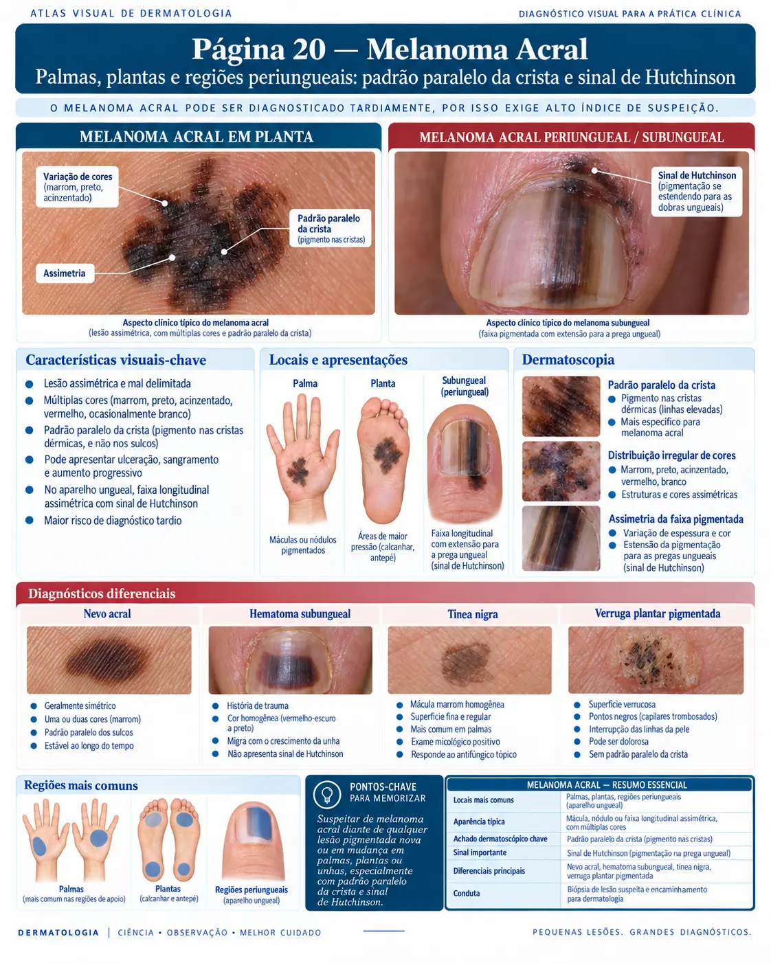 Página do ATLAS VISUAL DE CÂNCER DE PELE: Melanoma Acral