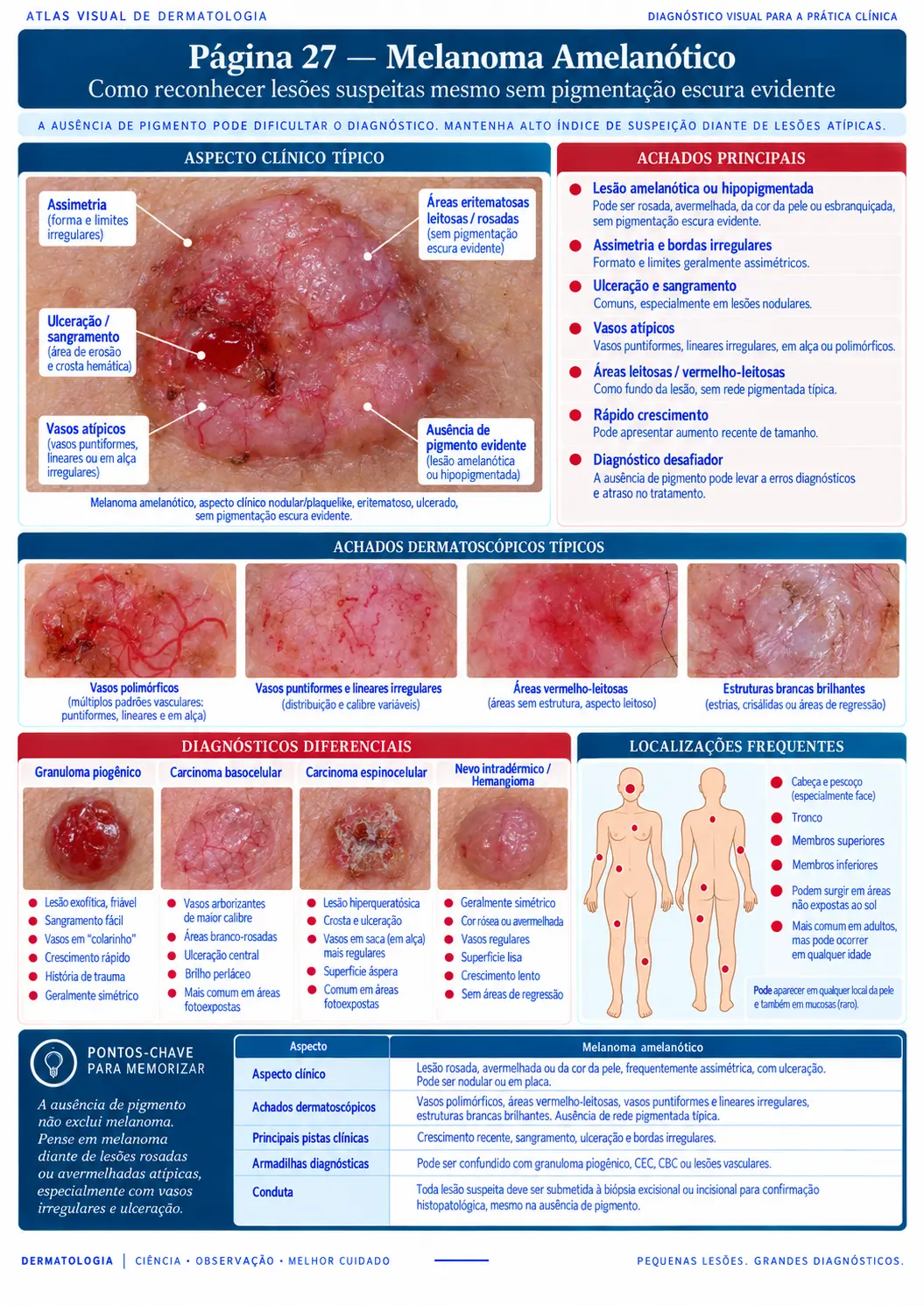 Página do ATLAS VISUAL DE CÂNCER DE PELE: Melanoma Amelanótico