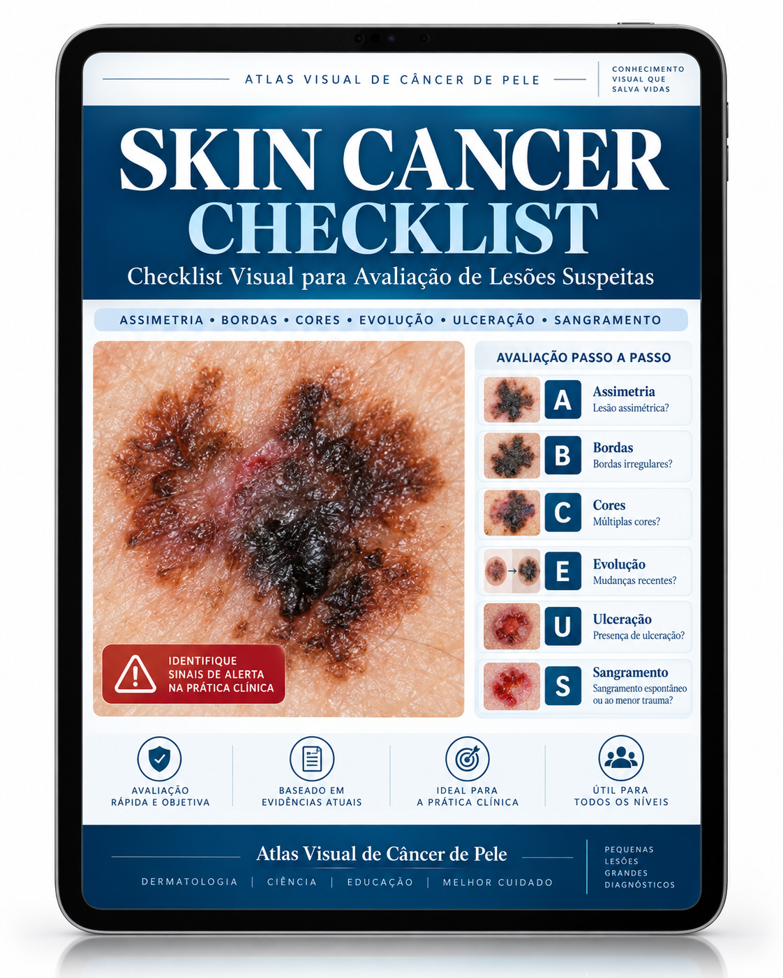 SKIN CANCER CHECKLIST